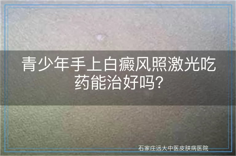 青少年手上白癜风照激光吃药能治好吗？