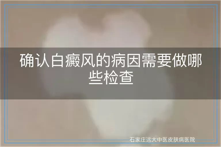 确认白癜风的病因需要做哪些检查