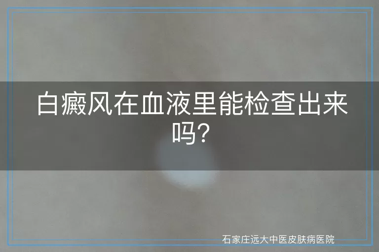 白癜风在血液里能检查出来吗？