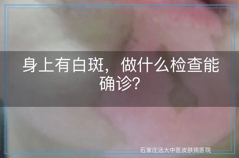 身上有白斑，做什么检查能确诊？