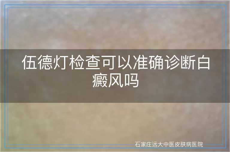 伍德灯检查可以准确诊断白癜风吗