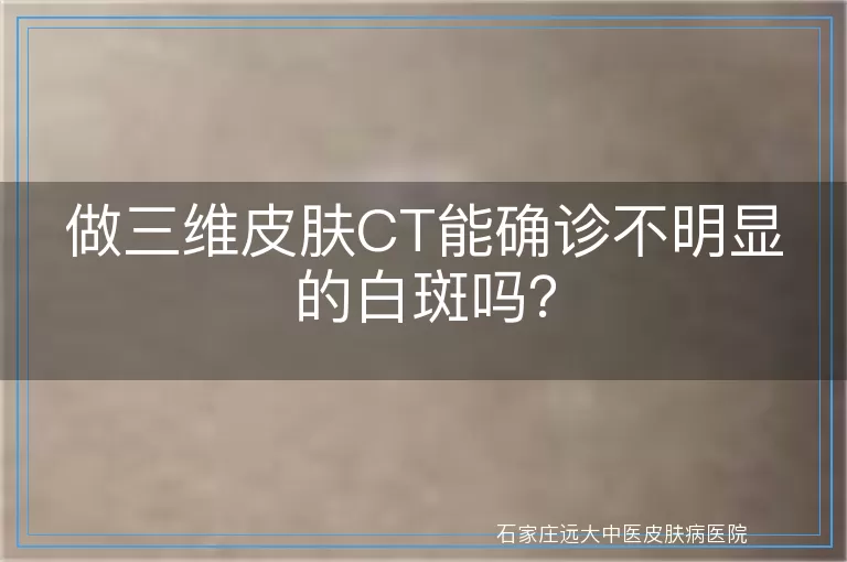 做三维皮肤CT能确诊不明显的白斑吗？