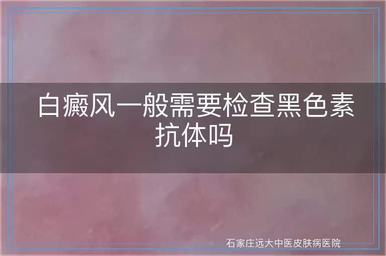 白癜风一般需要检查黑色素抗体吗