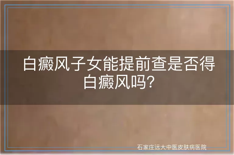 白癜风子女能提前查是否得白癜风吗？