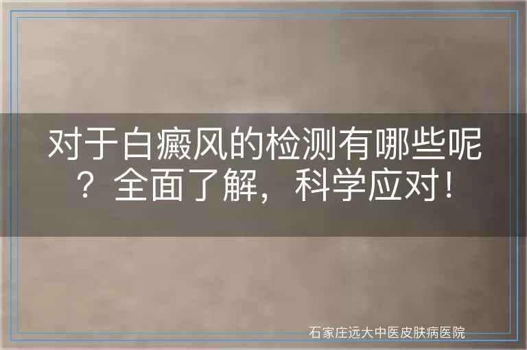 对于白癜风的检测有哪些呢？全面了解，科学应对！