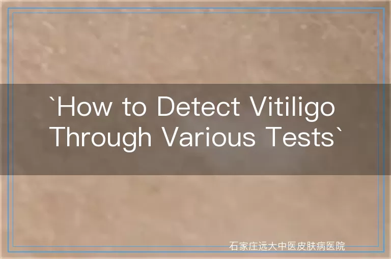 How to Detect Vitiligo Through Various Tests