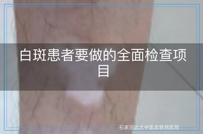 白斑患者要做的全面检查项目