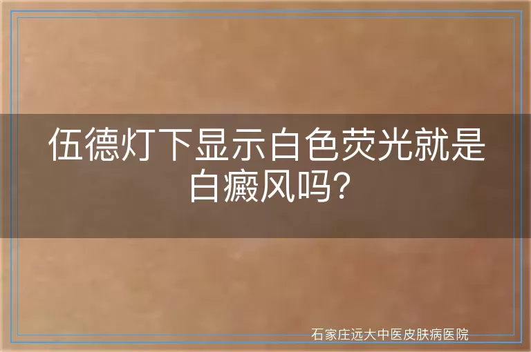 伍德灯下显示白色荧光就是白癜风吗？