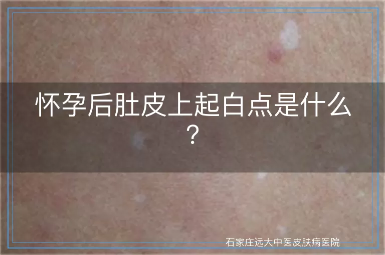 怀孕后肚皮上起白点是什么？