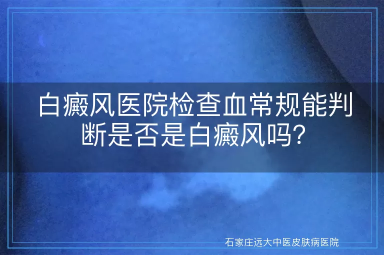 白癜风医院检查血常规能判断是否是白癜风吗？