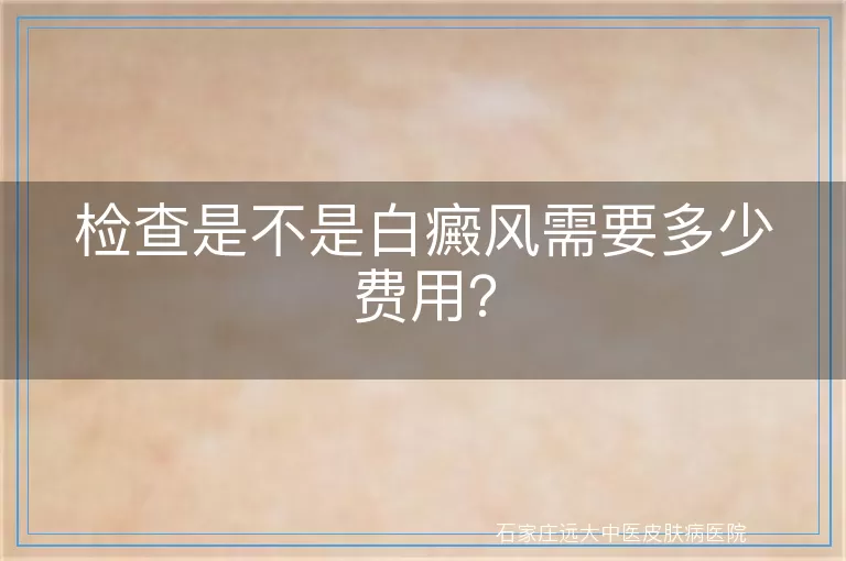 检查是不是白癜风需要多少费用？