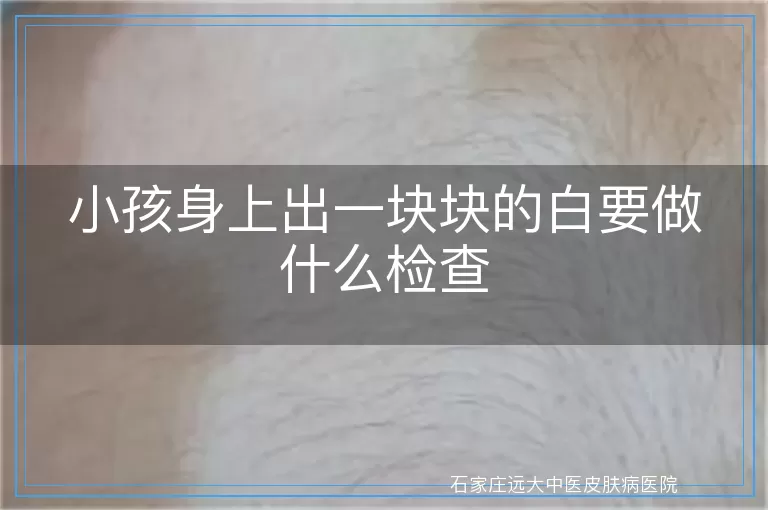 小孩身上出一块块的白要做什么检查