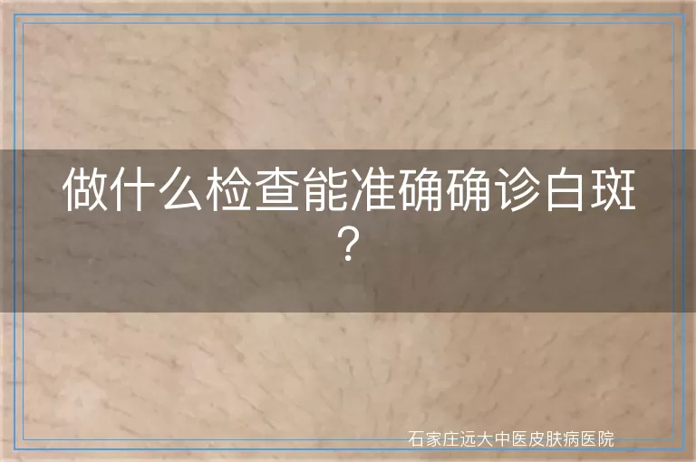 做什么检查能准确确诊白斑？