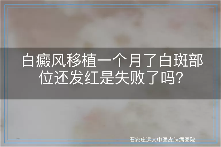 白癜风移植一个月了白斑部位还发红是失败了吗？