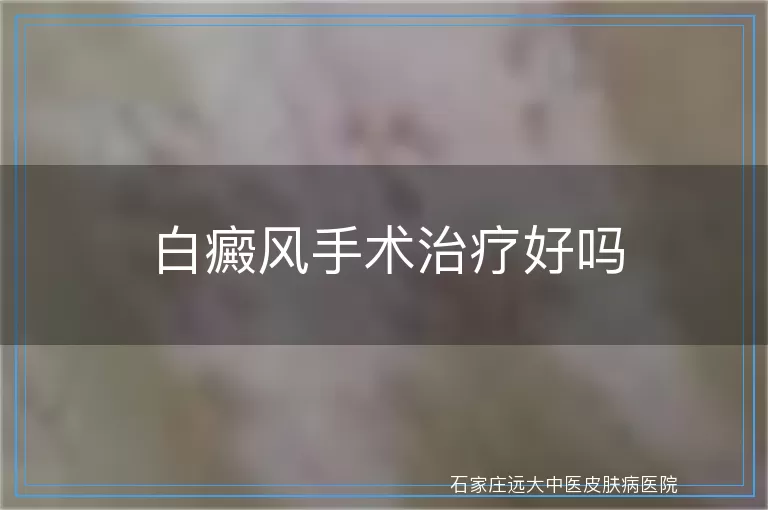 白癜风手术治疗好吗