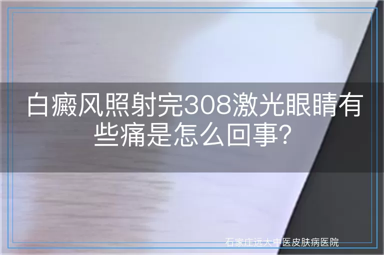 白癜风照射完308激光眼睛有些痛是怎么回事？