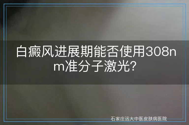 白癜风进展期能否使用308nm准分子激光？