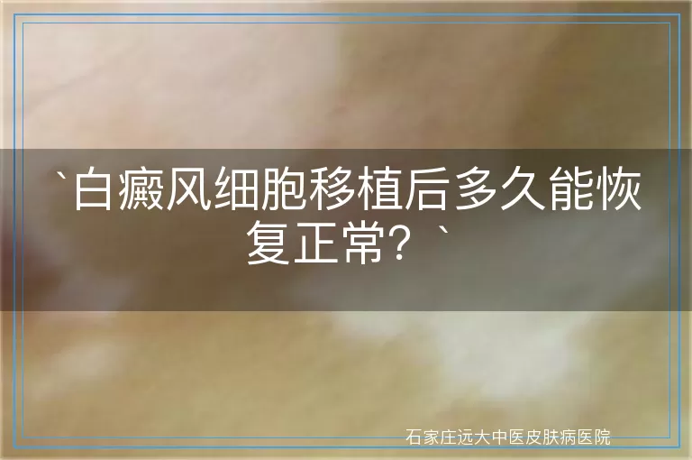 白癜风细胞移植后多久能恢复正常？