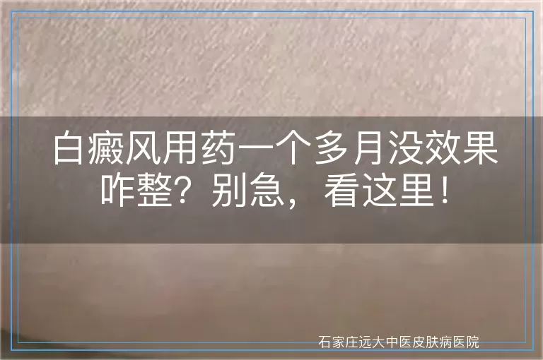 白癜风用药一个多月没效果咋整？别急，看这里！