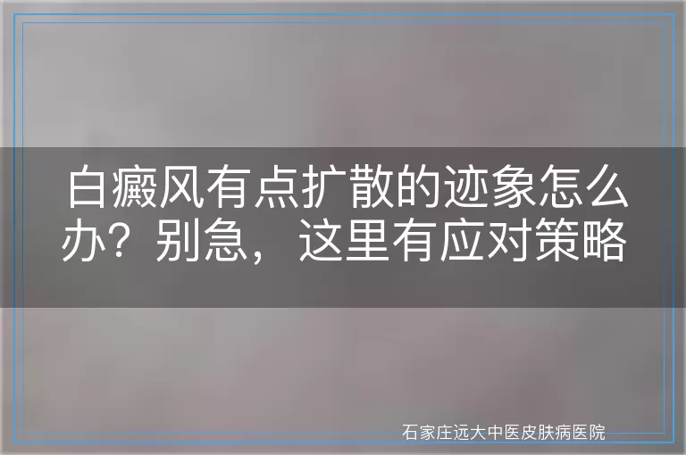 白癜风有点扩散的迹象怎么办？别急，这里有应对策略！