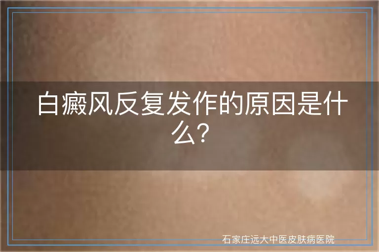 白癜风反复发作的原因是什么？