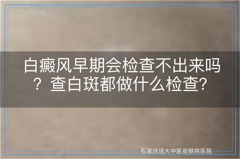 白癜风早期会检查不出来吗？查白斑都做什么检查？