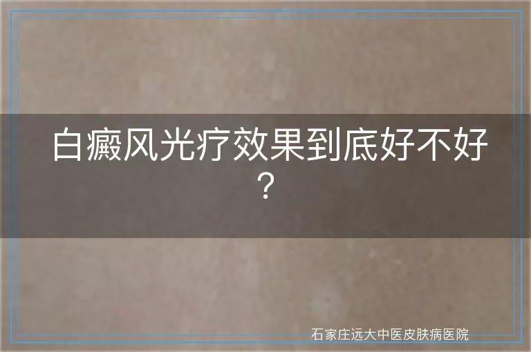 白癜风光疗效果到底好不好？