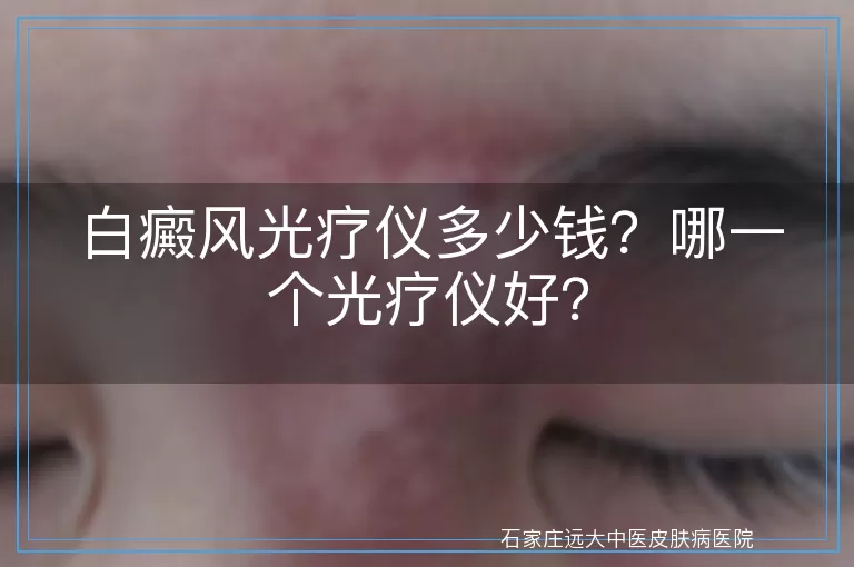 白癜风光疗仪多少钱？哪一个光疗仪好？