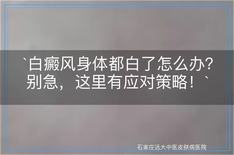 白癜风身体都白了怎么办？别急，这里有应对策略！