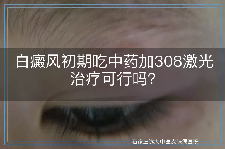 白癜风初期吃中药加308激光治疗可行吗？